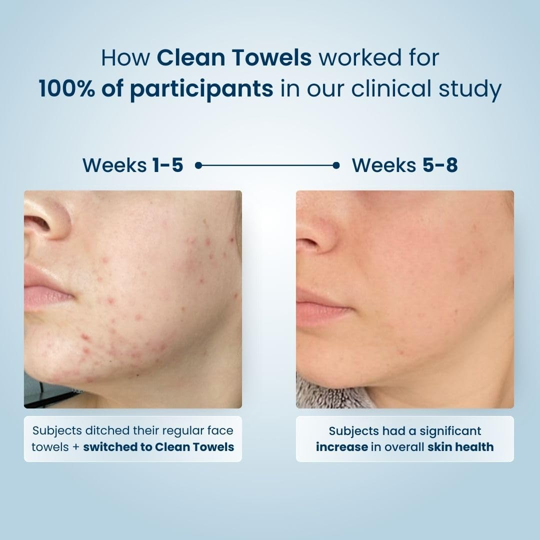 Face Towel, Disposable Face Towelette, Eczema Association Accepted,