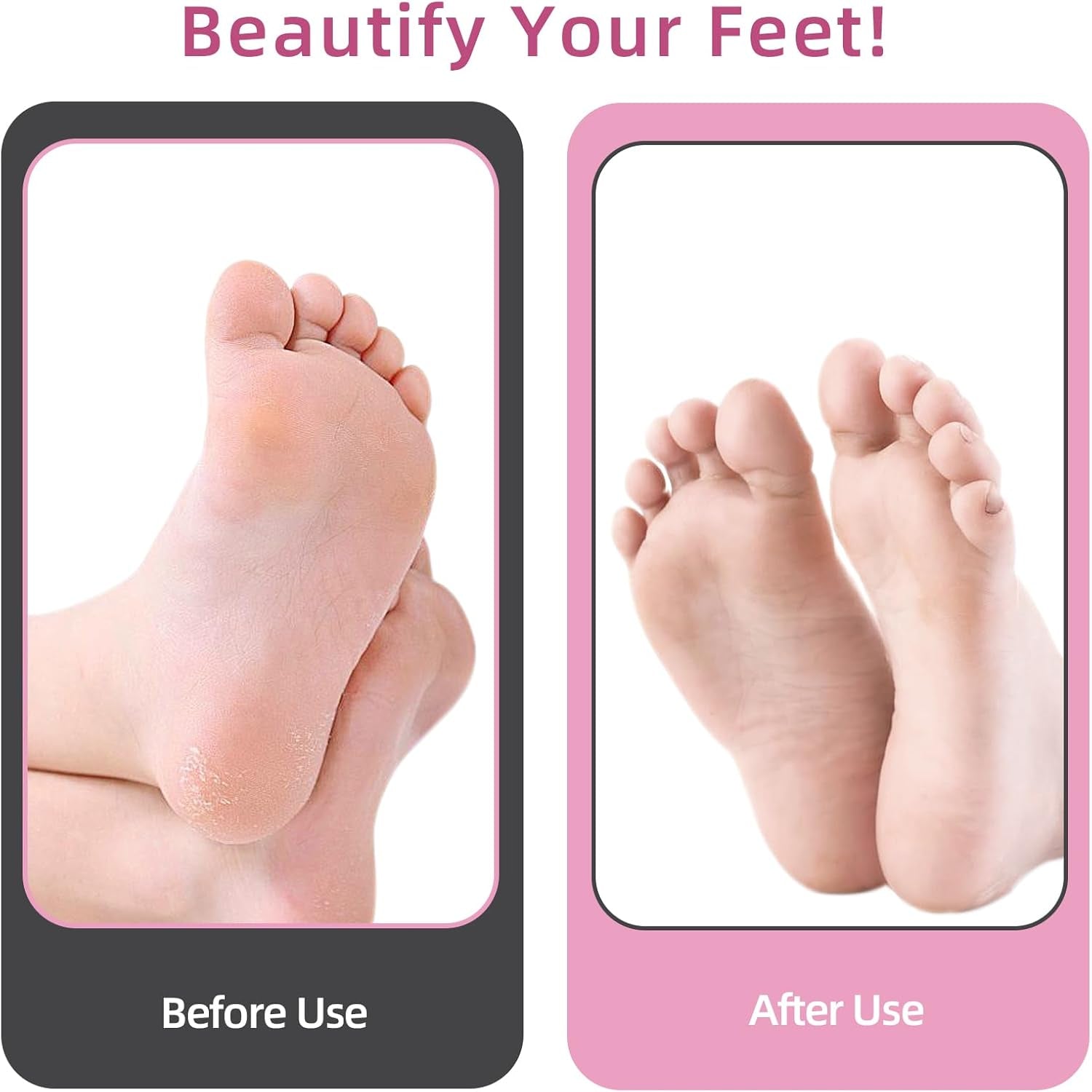Aluminum Callus Remover for Feet